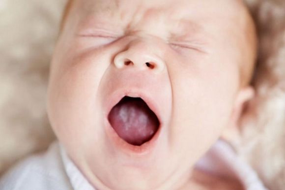 Белый налет на языке, на щеках во рту у грудничка при грудном и искусственном вскармливании ребенка: причины и лечение