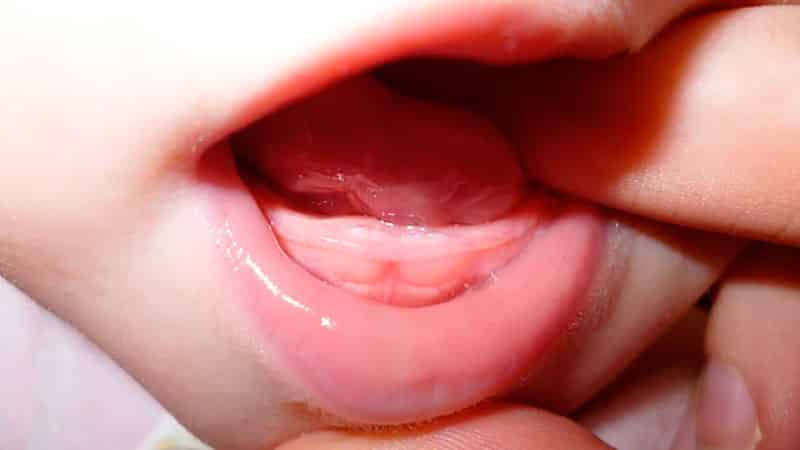 what to put on baby&#39;s gums when teething_1