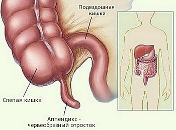 What is a vermiform appendix