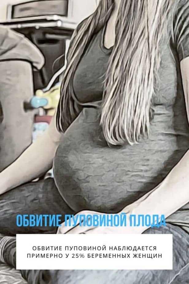 In order to avoid problems such as entanglement of the fetus with the umbilical cord during pregnancy, a pregnant woman, first of all, needs to lead a healthy lifestyle.