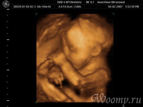 Photo of an ultrasound of a child at 37 weeks of pregnancy