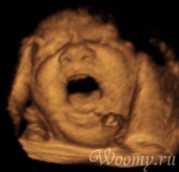 Фото УЗИ ребенка на 38 неделе беременности