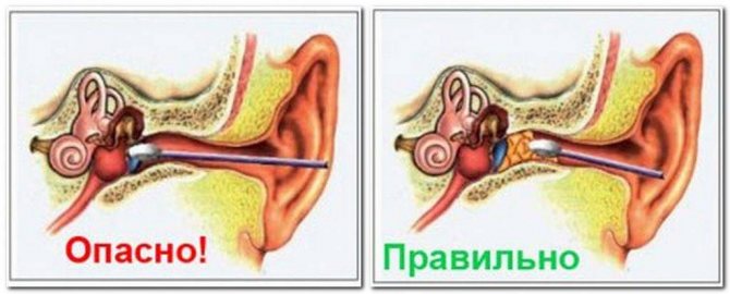 how to clean ear wax