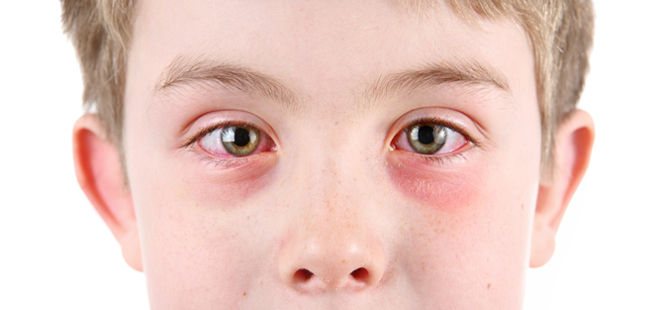 How to stop a child&#39;s dry cough at night: causes, treatment