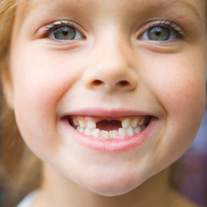 How to remove a loose tooth at home