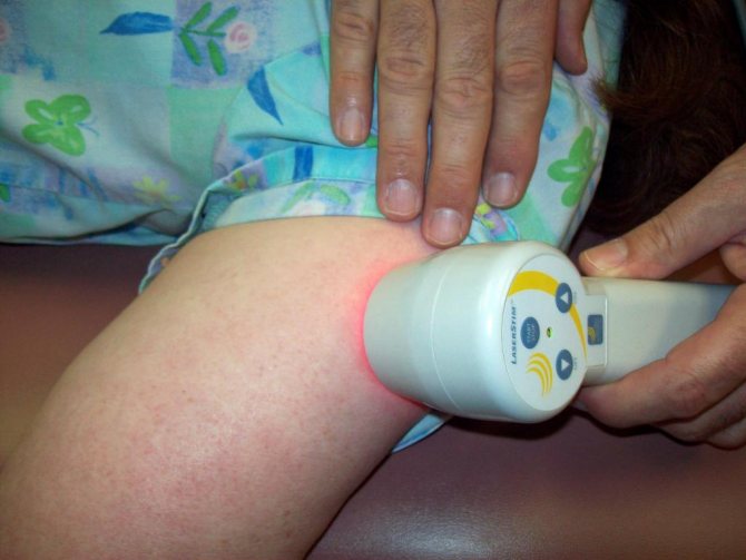Laser therapy for a child
