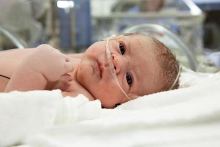 Newborn: asphyxia as a cause of perinatal cephalopathy