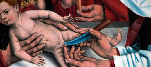 Обрезание у мальчиков - до и после: фото ребёнка, что такое обрезание и как оно выглядит