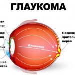 Причины глаукомы