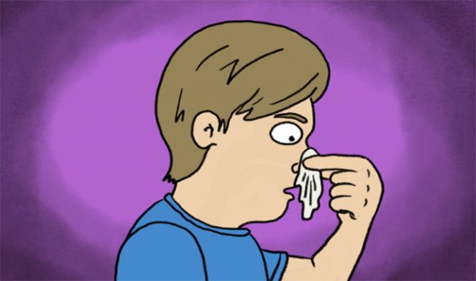 Причины носовых кровотечений