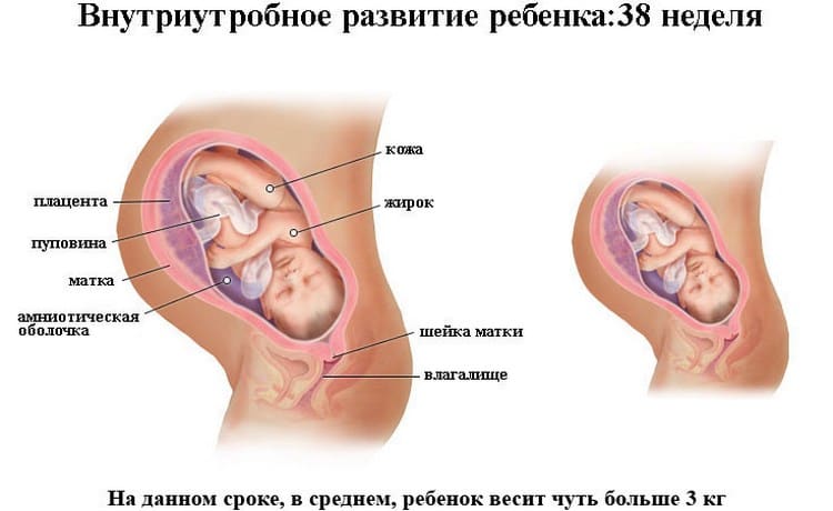 Распознайте признаки приближающихся родов при сроке в 38 недель беременности.