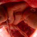 Ребенок на 8 месяце беременности в утробе матери