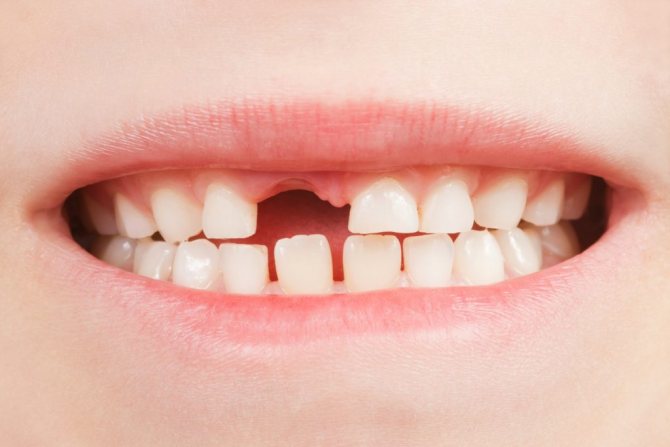Recommendations for handling baby teeth