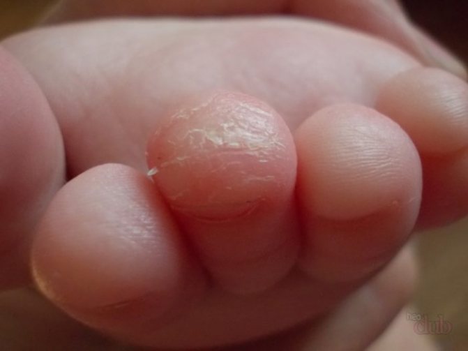 Children&#39;s fingers peel