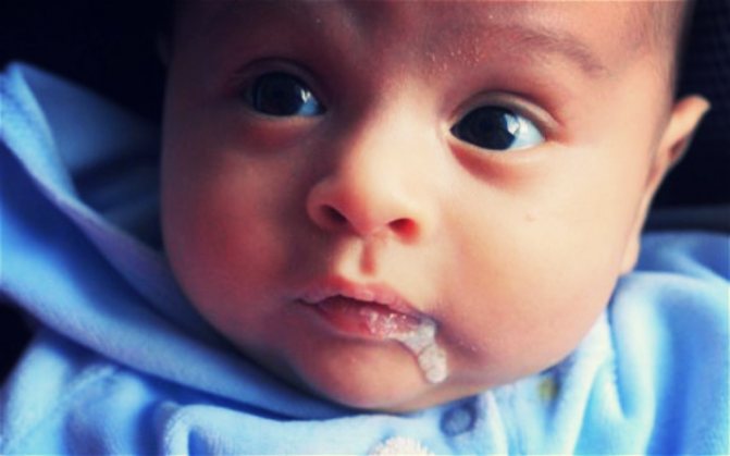 spitting up syndrome in babies