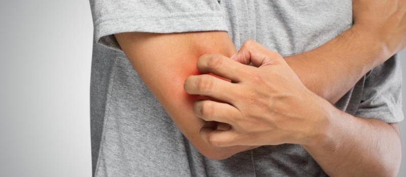 Rash on elbows and knees in a child - possible causes and treatment features