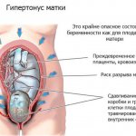 Uterine tone in an expectant mother