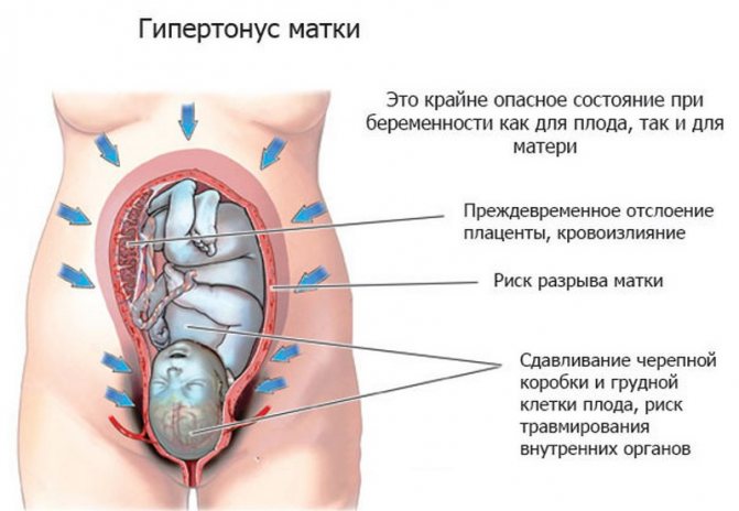 Uterine tone in an expectant mother