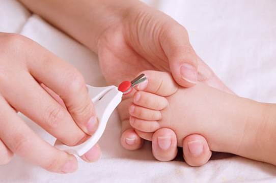 Ingrown toenail in a newborn