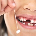 Выпадение зубов у детей