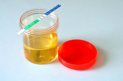 Yellow liquid in container