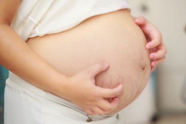 Зуд кожи при беременности